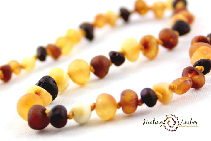 Baltic Amber Bracelet/Anklet - 5.5"